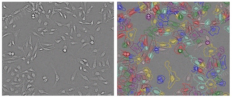 1756656943539.jpg 激光共聚焦高內涵細胞成像分析儀