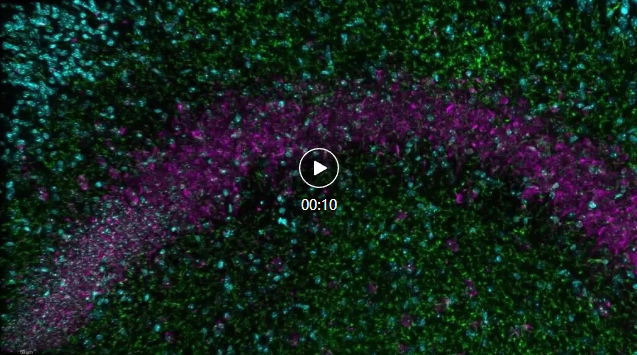 显微课堂 | 神经科学图像